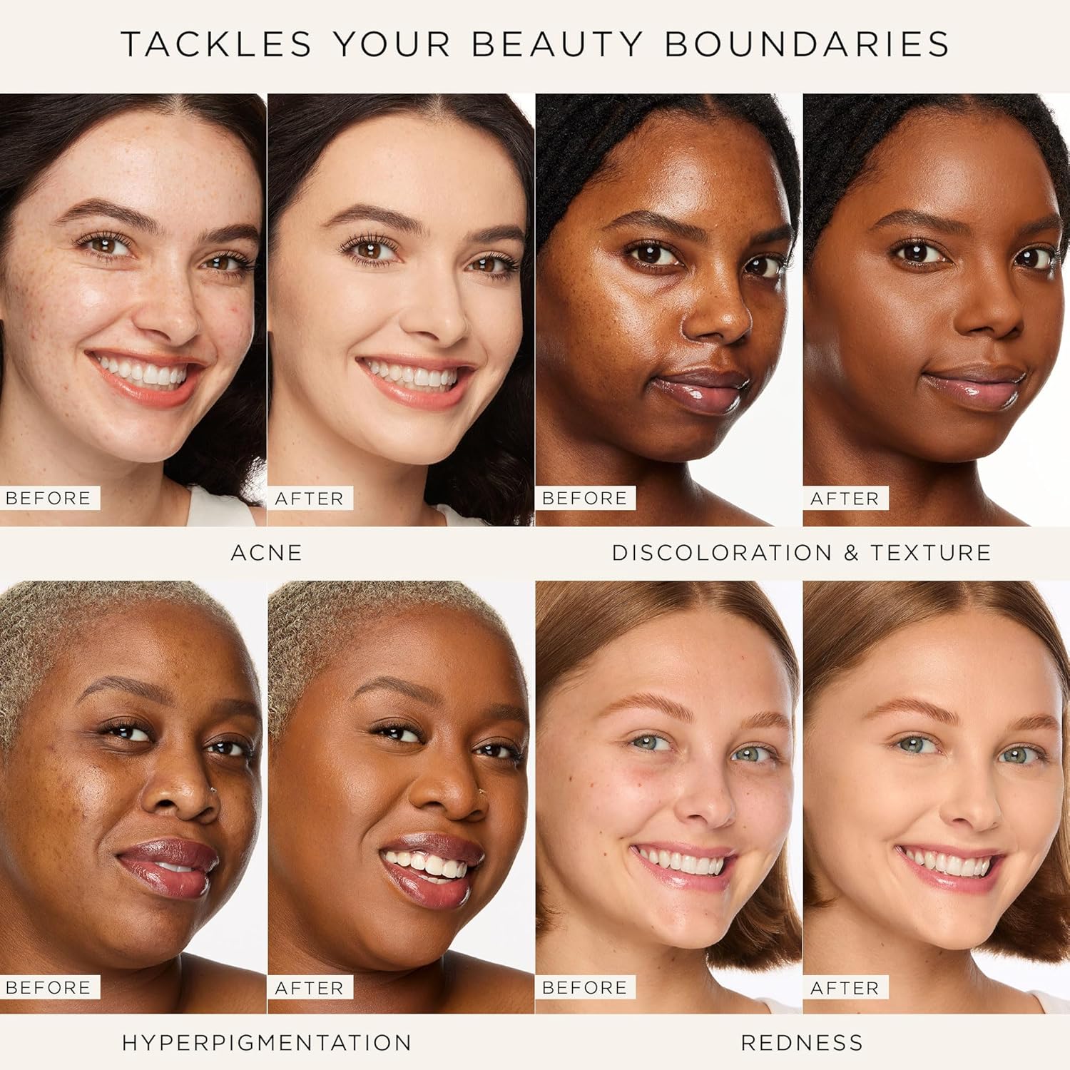 tarte shape tape full-coverage concealer, Matte Finish, Longwear, Dermatologist-Tested, Vegan