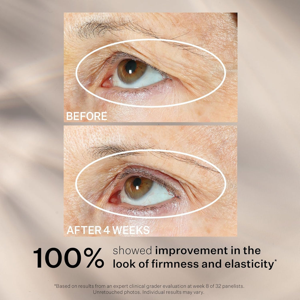 StriVectin Tighten and Lift Peptight 360 Degree Eye Serum with Tightening and Brightening Peptides