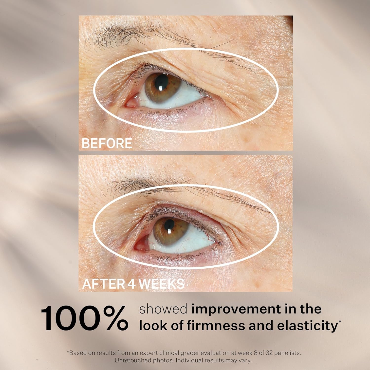 StriVectin Tighten and Lift Peptight 360 Degree Eye Serum with Tightening and Brightening Peptides