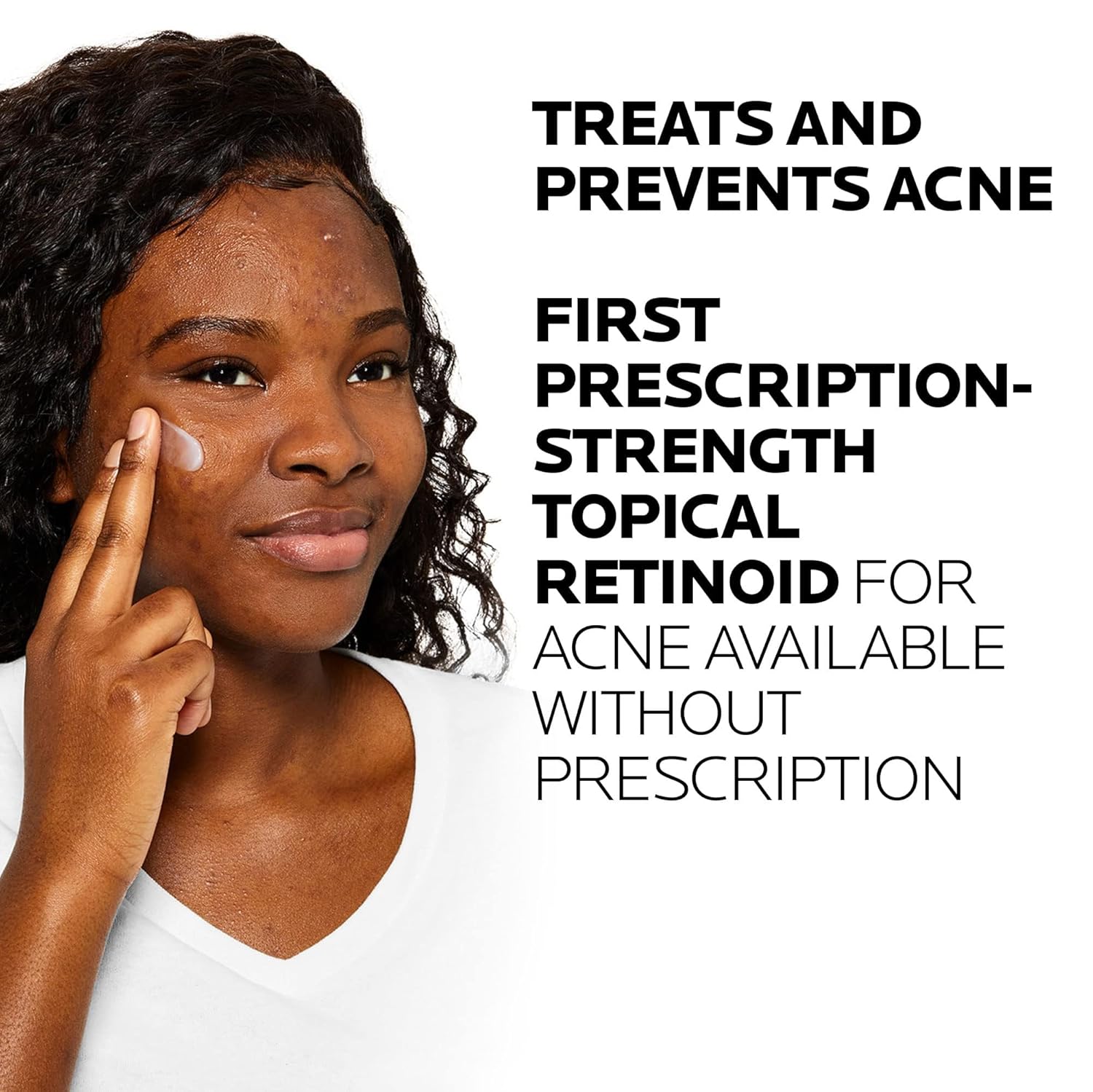 La Roche-Posay Effaclar Adapalene Gel 0.1% Acne Treatment, Retinoid Cream, Acne Medication Gel