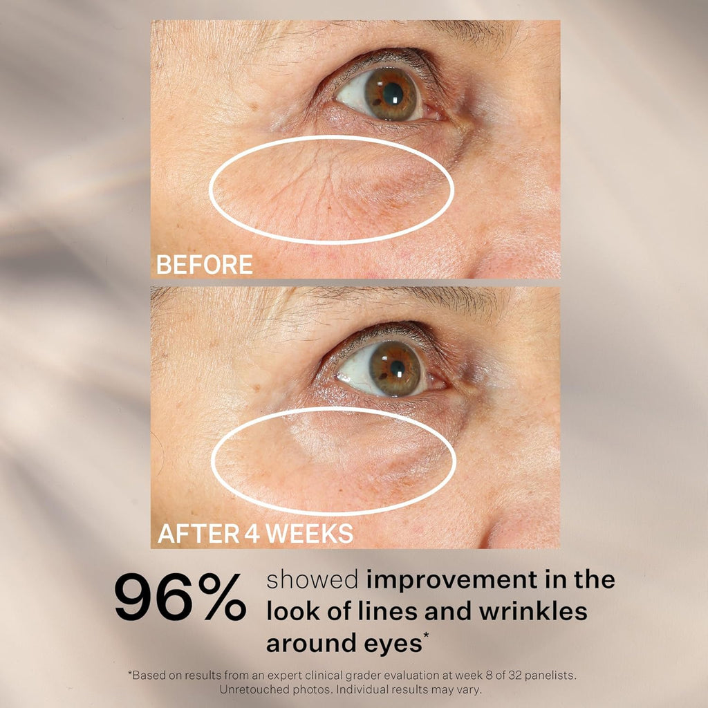 StriVectin Tighten and Lift Peptight 360 Degree Eye Serum with Tightening and Brightening Peptides