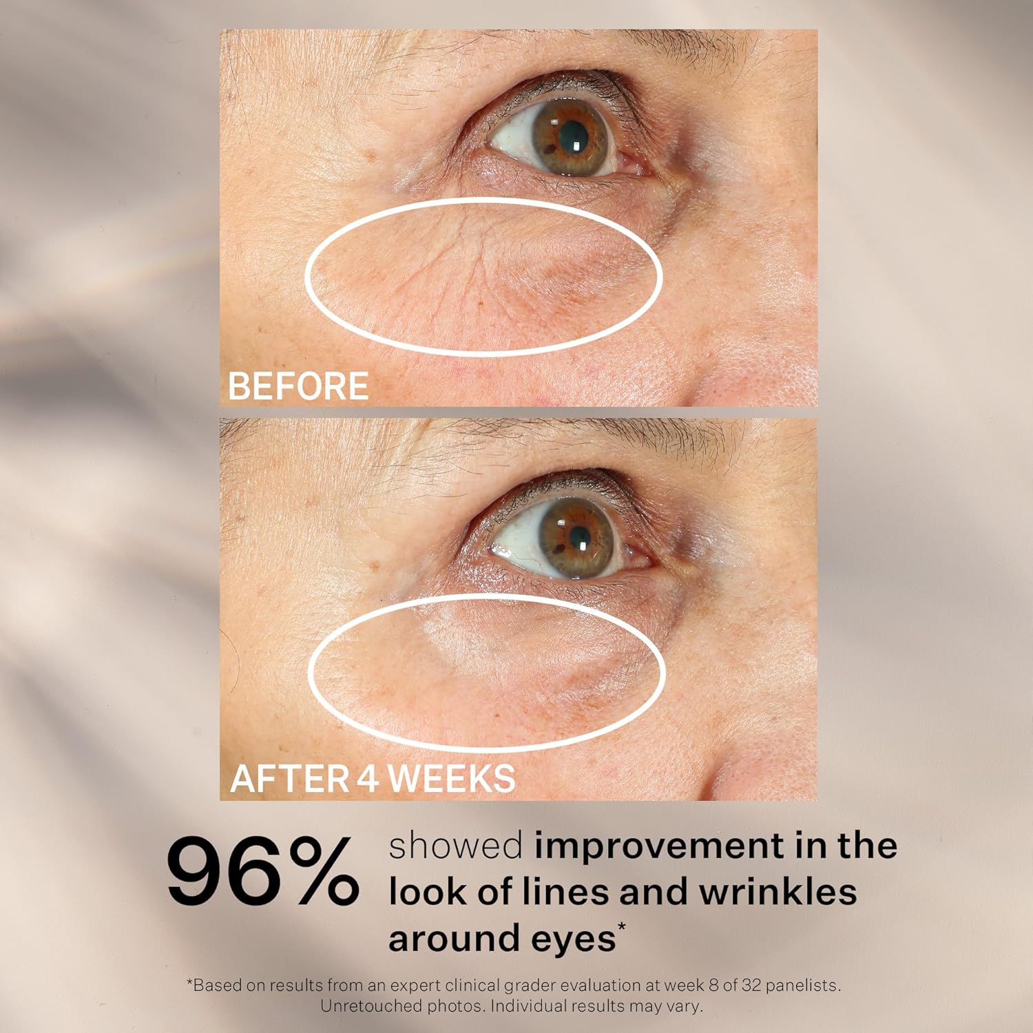 StriVectin Tighten and Lift Peptight 360 Degree Eye Serum with Tightening and Brightening Peptides
