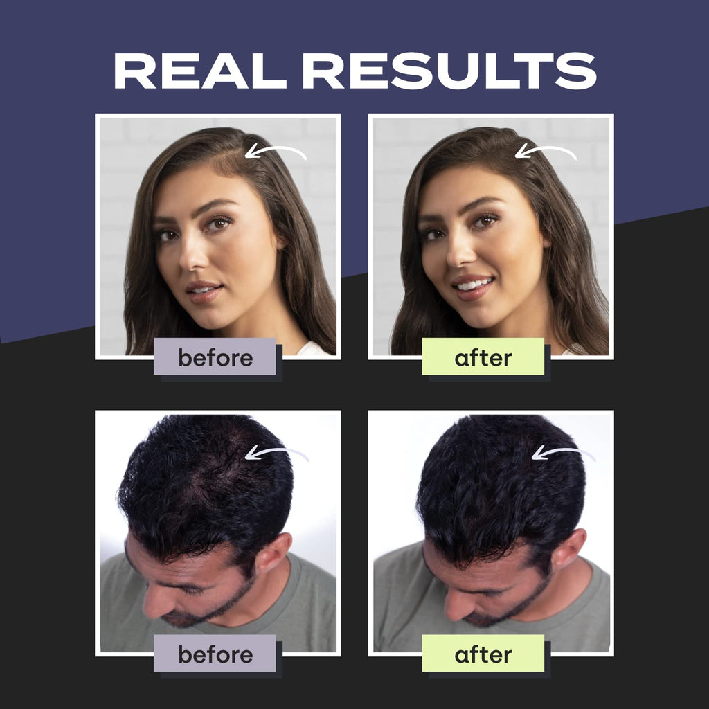 Toppik Hair Building Fibers, 12g Fill In Fine or Thinning Hair, Instantly Thicker, Fuller, Keratin